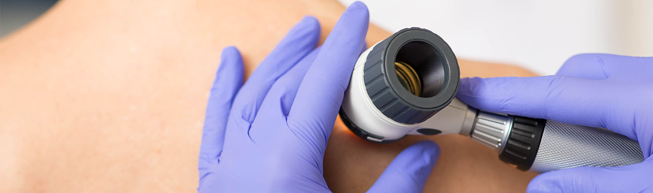 Eine Hautärztin in Hamm untersucht beim Hautkrebs-Screening den Rücken einer weiblichen Patientin mit einem Dermatoskop